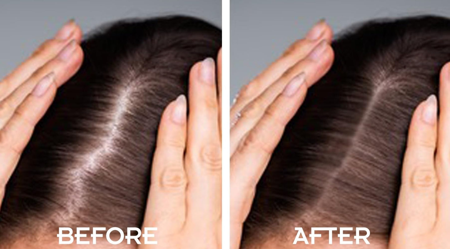 MY HAIR DOCTOR MHD Root Touch Up | Root Touch Up Powder for Colour Touch Up & Hair Root Cover Up | Easy Application for Instant Root Cover Up & Grey Coverage | 2.7g Light Brown