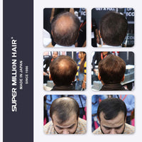 Super Million Hair - No.3 Light Brown - 15g Hair Fibres