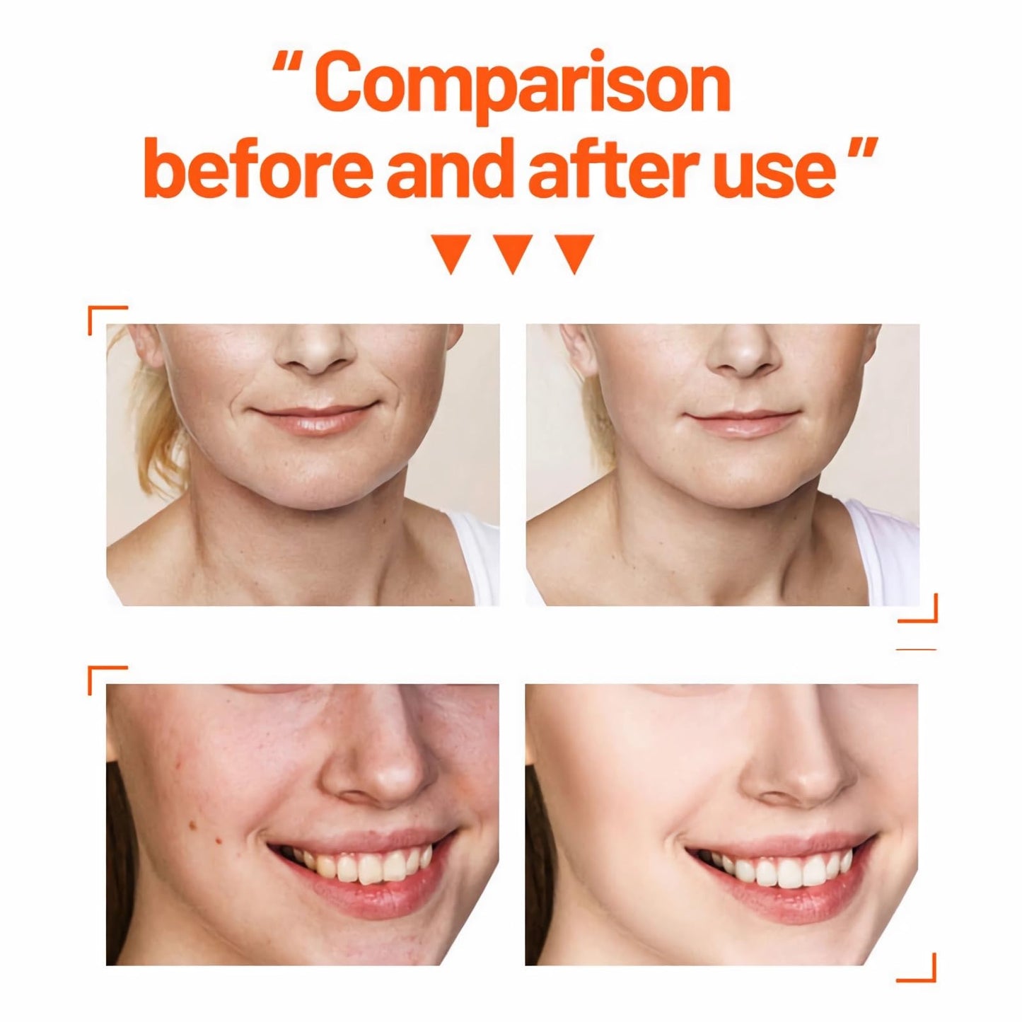 mercham Skincare Set Gifts for Teenage Girls-Vitamin C Serum for Womens Gift Sets, Includes Cleanser-Toner-Serum-Face Cream, Moisturizing & Brightening Facial Kit, Preppy Skincare Set - All Skin Types