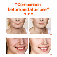 mercham Skincare Set Gifts for Teenage Girls-Vitamin C Serum for Womens Gift Sets, Includes Cleanser-Toner-Serum-Face Cream, Moisturizing & Brightening Facial Kit, Preppy Skincare Set - All Skin Types