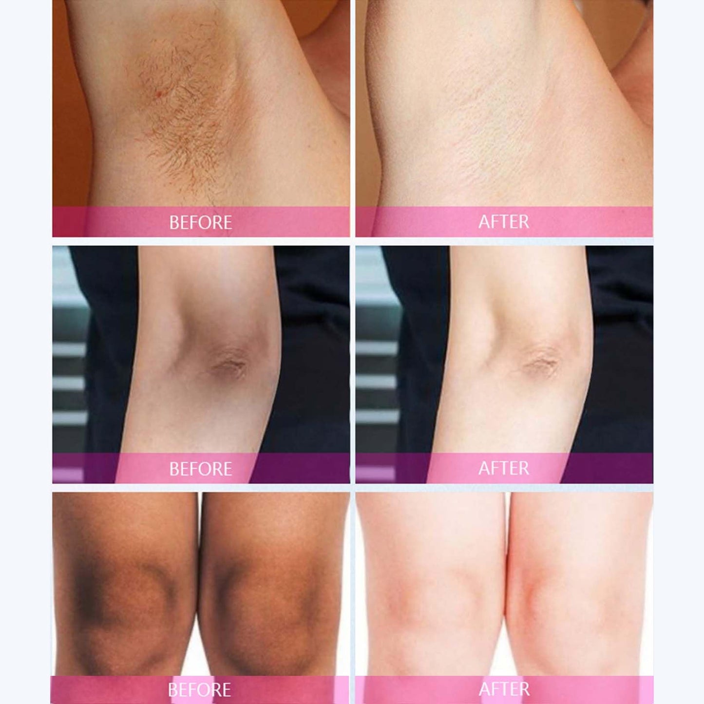 OlymGrow Kojic Acid Cream – Brightens Underarms, Knees, Inner Thighs & Intimate Areas. Dark Spot Corrector for Body, Armpits & Acanthosis Nigricans. Lightens & Evens Skin Tone