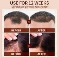 Generic Hair Growth Elixir, Natural Herbal Oil Serum, 50ml, for Hair Loss Treatment and Scalp Care