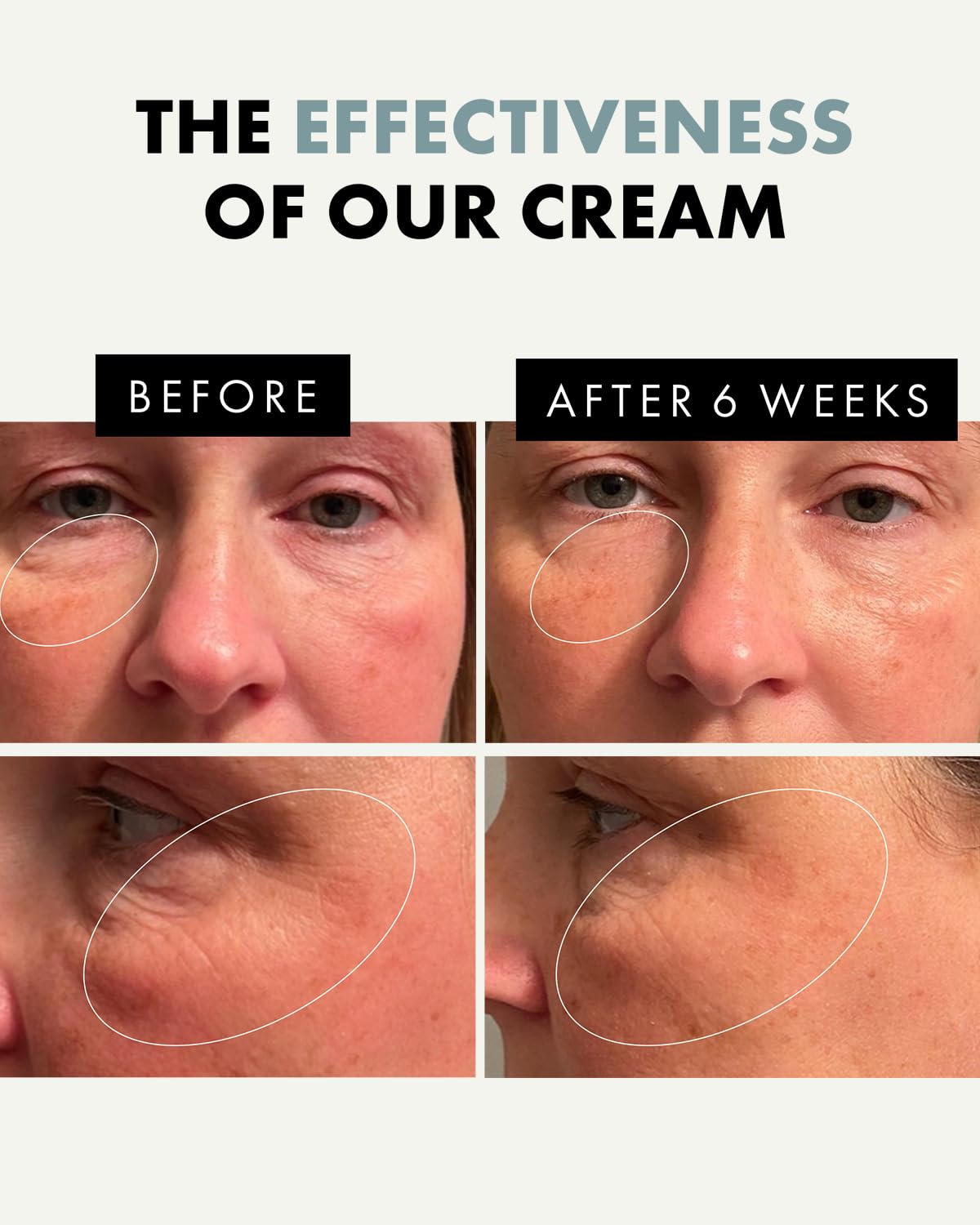 Eclat Skincare Under Eye Cream for Dark Circles and Puffy Eyes - Plumping Eye Cream Anti Aging, Dark Circle Eye Cream - Moisturizer for Puffy Eyes, Soothing Oat Extract, HA and Antioxidants – Brightening Eye Cream
