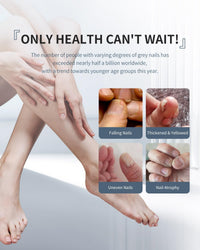 KTS Fungal Nail Treatment,Anti Fungal Nail Treatment For Toenails Extra Strong Laser Device,7 Mins Per Day Blue Light Nail Fungus Treatment For Toenail,Toe Nail Fungal Treatment At Home
