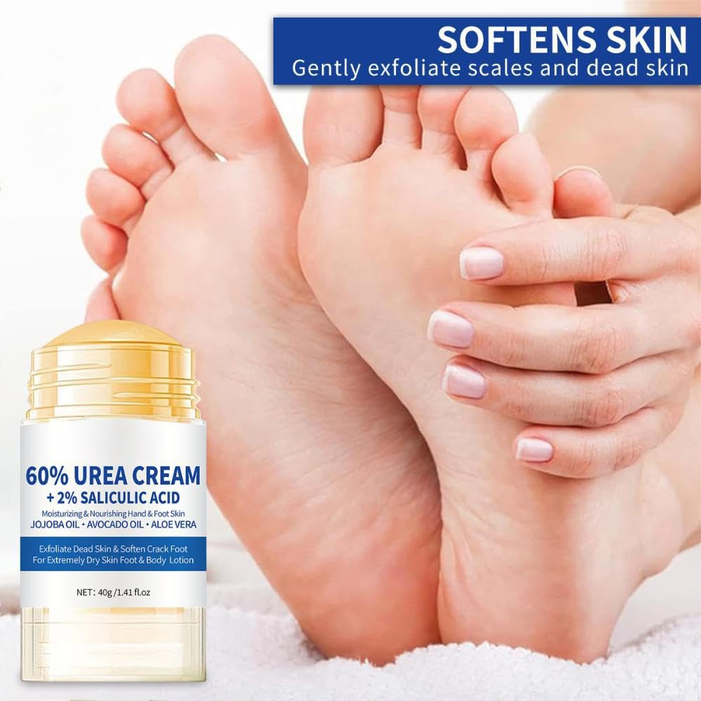 ZoeyShine 60% Urea Foot Cream for Cracked Heels and Dry Skin, Cracked Heel Cream, Skin Care Hands & Feet, Fast Absorbing Non-Greasy Formula with Moisturizing Ingredients