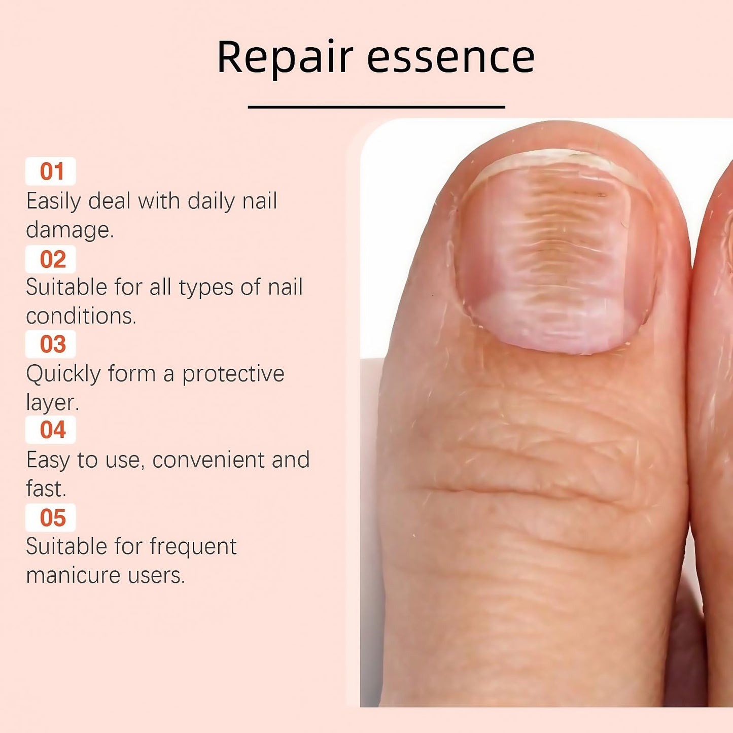 Ingrown Toenail Treatment Drop,Nail Growth Ingrowing Toenail Treatment,Cuticle Care Oils for Ingrown Toenails,Nail Growth Treatment,Ingrowing Toe Nail Treatment,Toe Nail Fungus Treatment Cuticle Oil