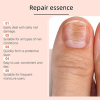 Ingrown Toenail Treatment Drop,Nail Growth Ingrowing Toenail Treatment,Cuticle Care Oils for Ingrown Toenails,Nail Growth Treatment,Ingrowing Toe Nail Treatment,Toe Nail Fungus Treatment Cuticle Oil