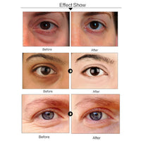 OVALA 60 PCS Aloe Vera Eye Masks, Gel Collagen Under Eye Patches for Puffy Eyes and Dark Circles Treatments, Reduce Wrinkles and Fine Lines Undereye Patches