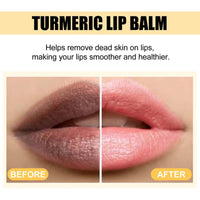 SHEBEEDO Lip Balm, Turmeric Lip Balm,Lip Lightening For Dark Lips,Long Lasting Moisturizing Lip Care Cream, Nourishes Lips, Reduces Chapped Dry Lips, Repairs Cracks,Natural Bright Lip Mask For Women Men