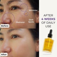 Karmic Skin Anti Ageing Face Serum: Bakuchiol + Vitamin C | Wrinkles, Dark Spots, Hyperpigmentation Night Treatment | Best Natural Retinol | Hydrating Collagen Boosting Facial Oil | Dark Spot Remover