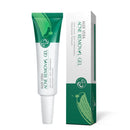 Acne Spot Treatment Cream, Aloe Vera Acne Removal Gel, Spot Cream Targets Acne, Pimples, Blemishes and Blackhead Removal, Acne Cream Anti-Acne, Oil-control, Remove pimples, Shrink Pores