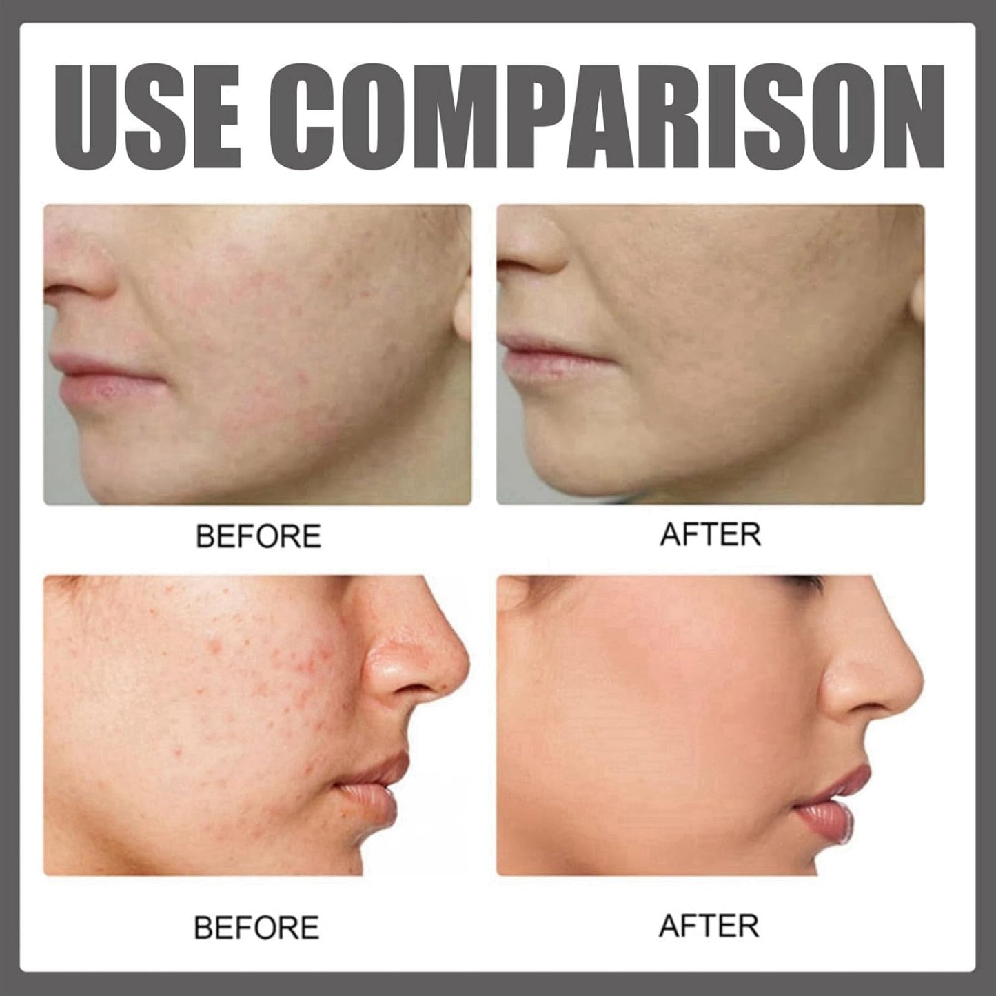 Haiyox Deep Serum Rice + Alpha-Arbutin,Face Serum,Serum with Rice Extract and Niacinamide Moisturiser Face,Hyaluronic Acid Face Serums,Anti Wrinkle Serum,Brightening Serum,Anti Aging Serum For Face