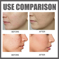 Haiyox Deep Serum Rice + Alpha-Arbutin,Face Serum,Serum with Rice Extract and Niacinamide Moisturiser Face,Hyaluronic Acid Face Serums,Anti Wrinkle Serum,Brightening Serum,Anti Aging Serum For Face