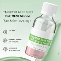 Cureluxe Anti Acne Serum - Acne Drying Lotion – Fast-Acting Blemish & Spot Treatment - Face Serum to Reduce Redness & Pimples - Dry Out Pimples,Clean Pores - Teen Girls, Women & Men Skin Care