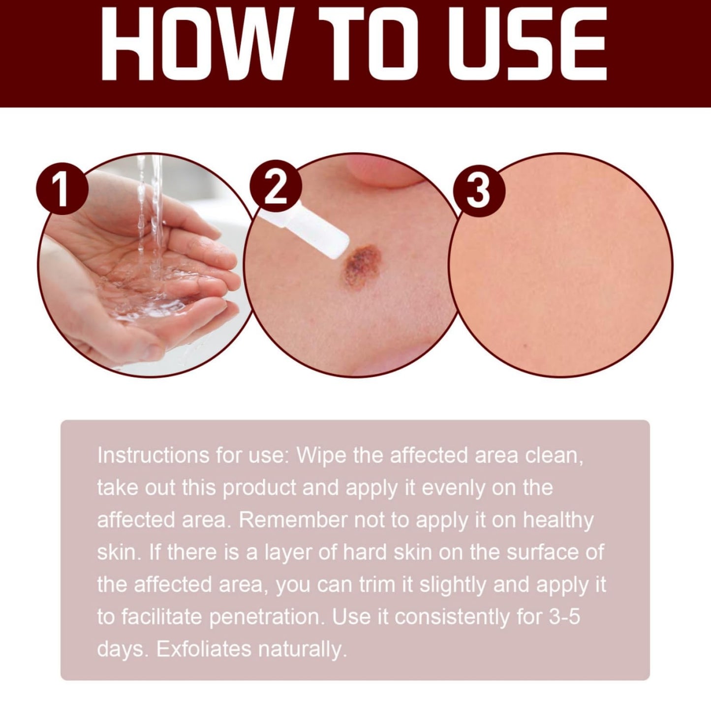 Wart Remover Pen,Mole and Wart Removal Pen,Dark Spots Treatments Mole Wa/rt Remover for Face,Liquid Pe/n Stops Regrowth Skin Care,Easy Removal P/en,Wa/rt Remov/ers for Sk/in Type,Verruca Treatments