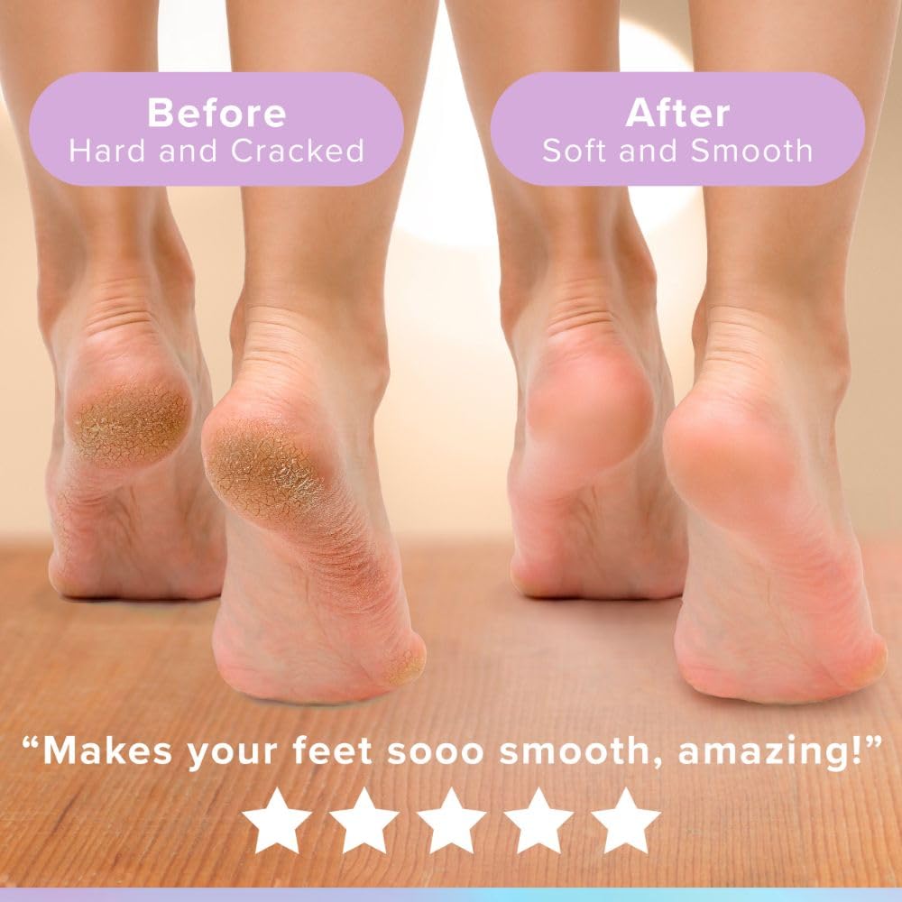 Glowxie Foot Cream & Foot Scrub Duo - 2 x 150ml Tubes – Exfoliates & Moisturises Dry, Hard Skin on Feet - Leaves Skin Smooth and Hydrated - Salicylic Acid - Vitamin Enriched - Natural Ingredients