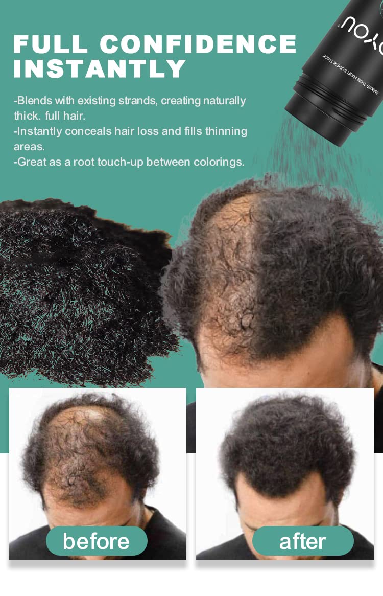 UOYOU DARK BROWN Hair Fibres for Thinning Hair 27.5g Bottle | Undetectable & Natural Keratin Hair Fibers Concealer for Hair Loss for Men and Women | Hair Building Fibres Powder [DARK BROWN]