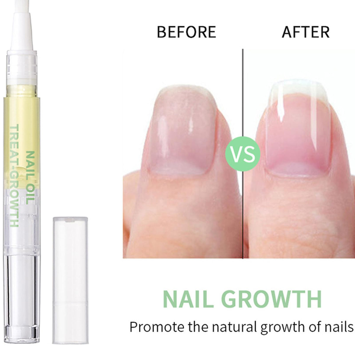 Generic 2 PCS Radiant Nail Growth Oil Pen - Cuticle and Nail Hydration Smooth Application Compact and Portable Design - Travel Friendly Quick Use Pen Applicator for Moisturize Dry Nails