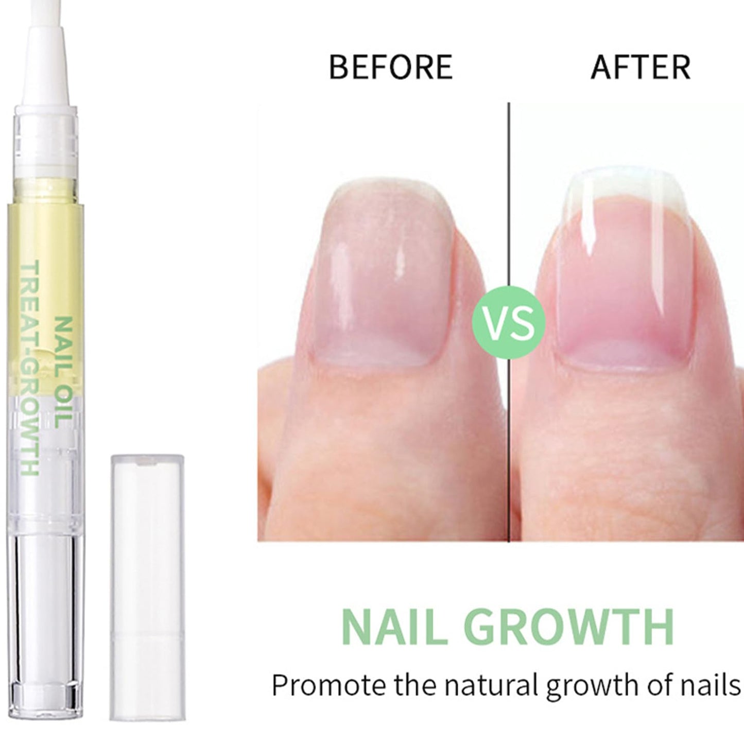 Generic 2 PCS Radiant Nail Growth Oil Pen - Cuticle and Nail Hydration Smooth Application Compact and Portable Design - Travel Friendly Quick Use Pen Applicator for Moisturize Dry Nails