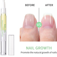 Generic 2 PCS Radiant Nail Growth Oil Pen - Cuticle and Nail Hydration Smooth Application Compact and Portable Design - Travel Friendly Quick Use Pen Applicator for Moisturize Dry Nails