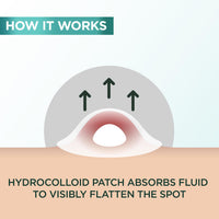 Garnier Blemish Patches, Hydrocolloid Patches to Reduce The Appearance of Spots in 8 Hours, Ultra-Thin & Invisible on All Skin Tones, Suitable for All Skin Types, Vegan Formula, 22 Patches