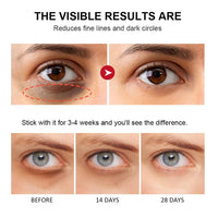 QEEROYO Retinol Eye Stick, Retinol Eye Cream, Eye Balm Stick, Eye Cream for Puffiness, Retinol Eye Cream for Dark Circles, Eye Brightener Stick for Dark Circles, Smoothens Wrinkle Eye Cream