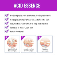 QinZiEn Acid Face Cream,Acid 12% Facial Serum Cream,Acne Treatment for Face,Skincare with Niacinamide & Vitamin C,Acne Scar Removal Cr/eam Night Serum for Face,Dark Spot Serum Crea/m,Acne Moisturiser,20g