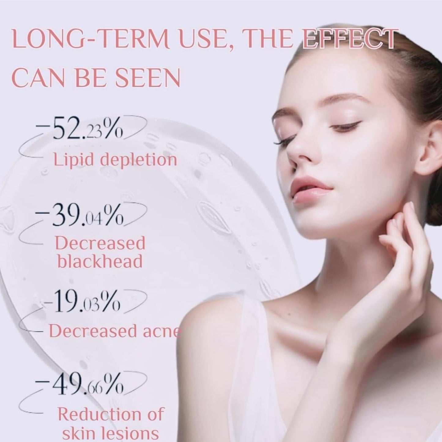 SingHao Aze-laic Acid 15% Acne Tratment Gel,15% Acid Acne Treatment Gel for Face,Azel-aic Acid Cream for Face,Acid Facial Serum,Aze-laic Ac/id Serum Cream with Niacinamide & Vitamin C,Anti Acne G/el for Spot