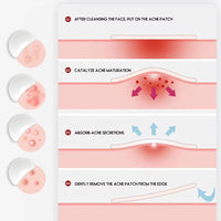 Pimple & Acne Patches, New Formula, Invisible Miracle Spot Cover - Hydrocolloid Acne Dressing Cover, Anti Acne Dots, Cruelty Free & Vegan, Pimple Stickers. (72)