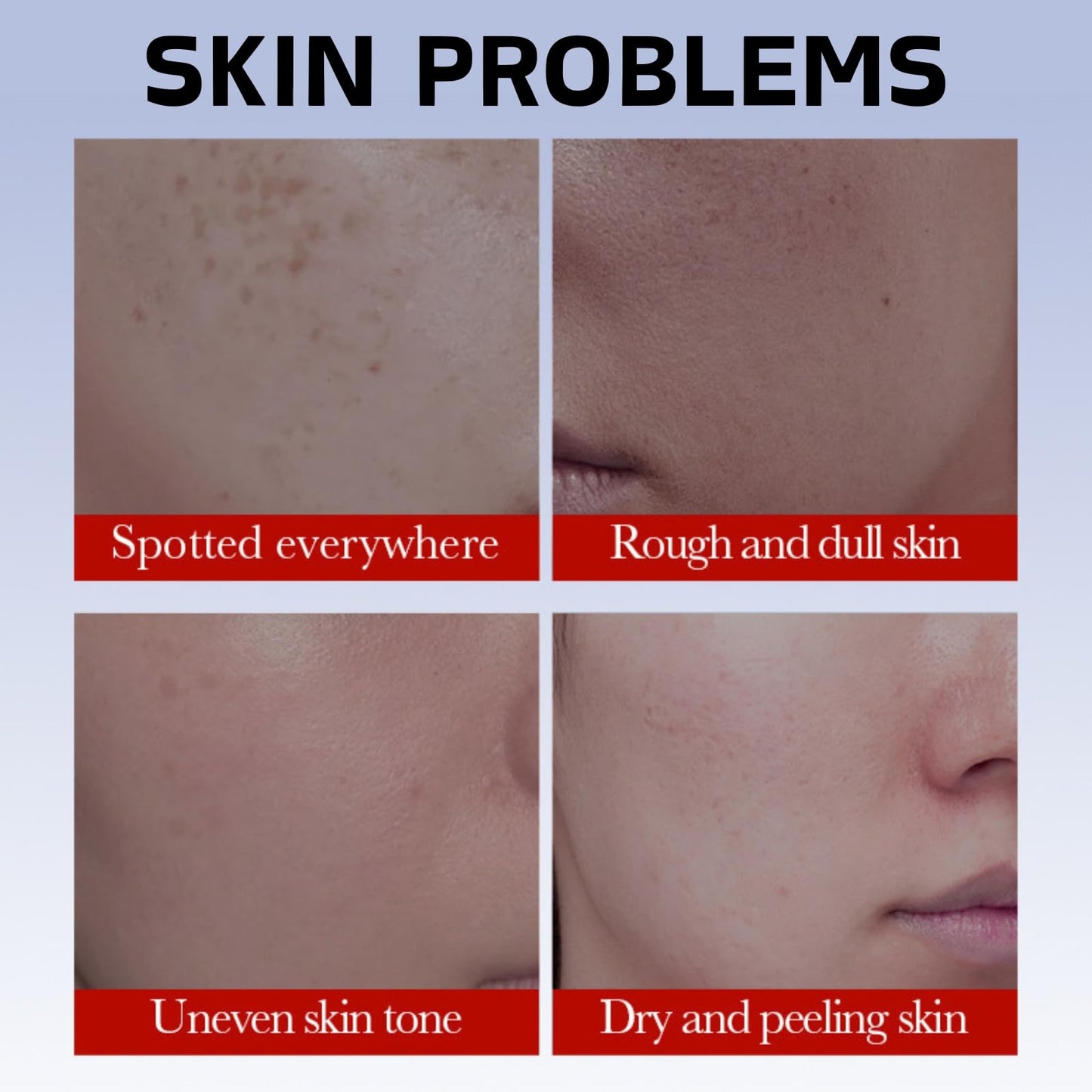 Freckle Removal Cream - Whitening Cream for Face - Whitening Freckle Creams for Acne Scar Removal - Anti Pigmentation Face Creams - Pigmentation Removal Face Creams - Face Cre-am for Women