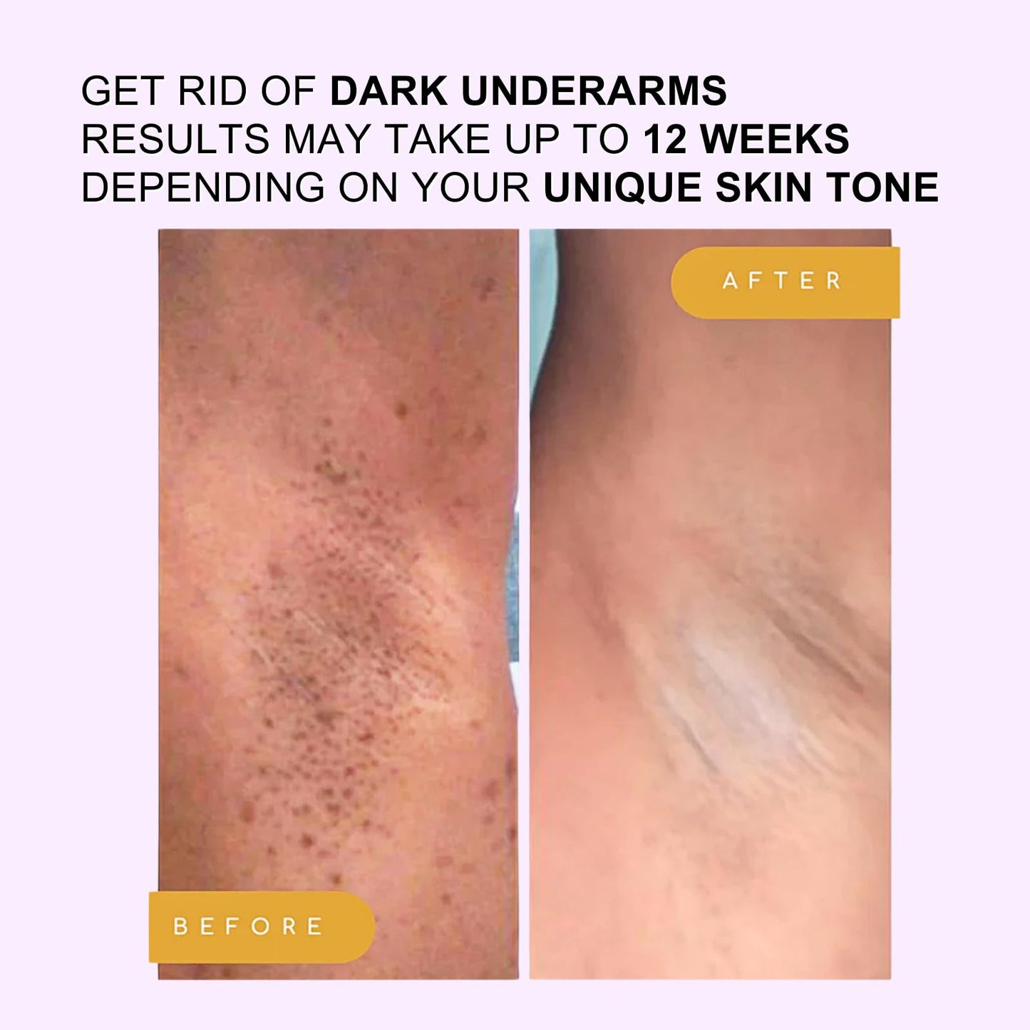 TBeautfave Skin Whitening Cream Stick for Body, Underarm Whitening Cream, Brightening Balm Stick with Niacinamide+Vitamin C, Skin Lightening Cream for Armpits/Knees/Elbows, Imorove Dullness, 28g