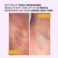 TBeautfave Skin Whitening Cream Stick for Body, Underarm Whitening Cream, Brightening Balm Stick with Niacinamide+Vitamin C, Skin Lightening Cream for Armpits/Knees/Elbows, Imorove Dullness, 28g