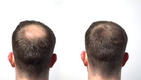 HairLab 100% Organic Hair-Thickening Keratin Fibres for Concealing Hair Loss and Thinning Hair -15g Dark Brown