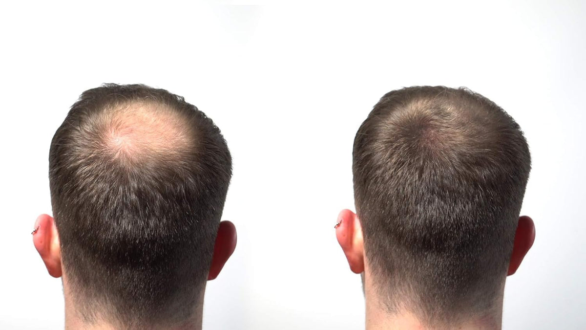 HairLab 100% Organic Hair-Thickening Keratin Fibres for Concealing Hair Loss and Thinning Hair - 15g Medium Brown