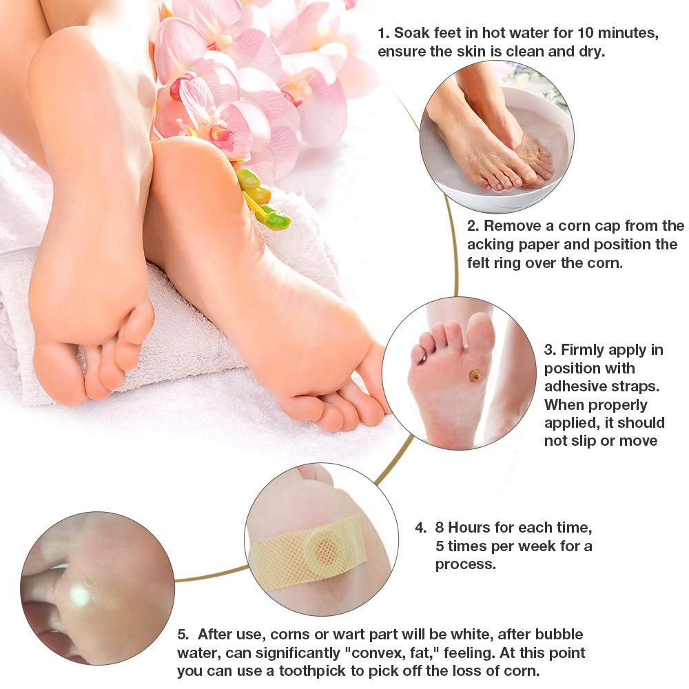 GNAPY Wart Removal Plasters, 24Pcs Wart Remover for Hands Feet Corn Removal Plaster with Hole, Remover Plantar Warts, Callus, Stops Wart Regrowth (A)