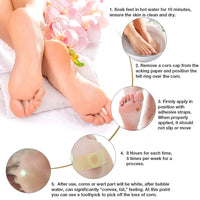 GNAPY Wart Removal Plasters, 24Pcs Wart Remover for Hands Feet Corn Removal Plaster with Hole, Remover Plantar Warts, Callus, Stops Wart Regrowth (A)