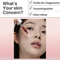 HEIMISH RX AHA BHA 30% Peeling Serum - Wash-off Peeling Serum, Chemical Peel for Blackheads, Pore and Sebum, Gentle Face Exfoliant for Oily and Acne-prone skin, Korean Skincare, 35ml (1.18 fl. oz)