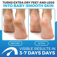 Imperial Feet Foot Balm Blue for Dry Feet Skin Remover-150ML Honey Balm Hard Skin Remover Foot-Cracked Heel Repair Cream-Athletes Foot Cream-Heel Balm for Soft, Smooth, Moisturize & Soothes Dry Skin