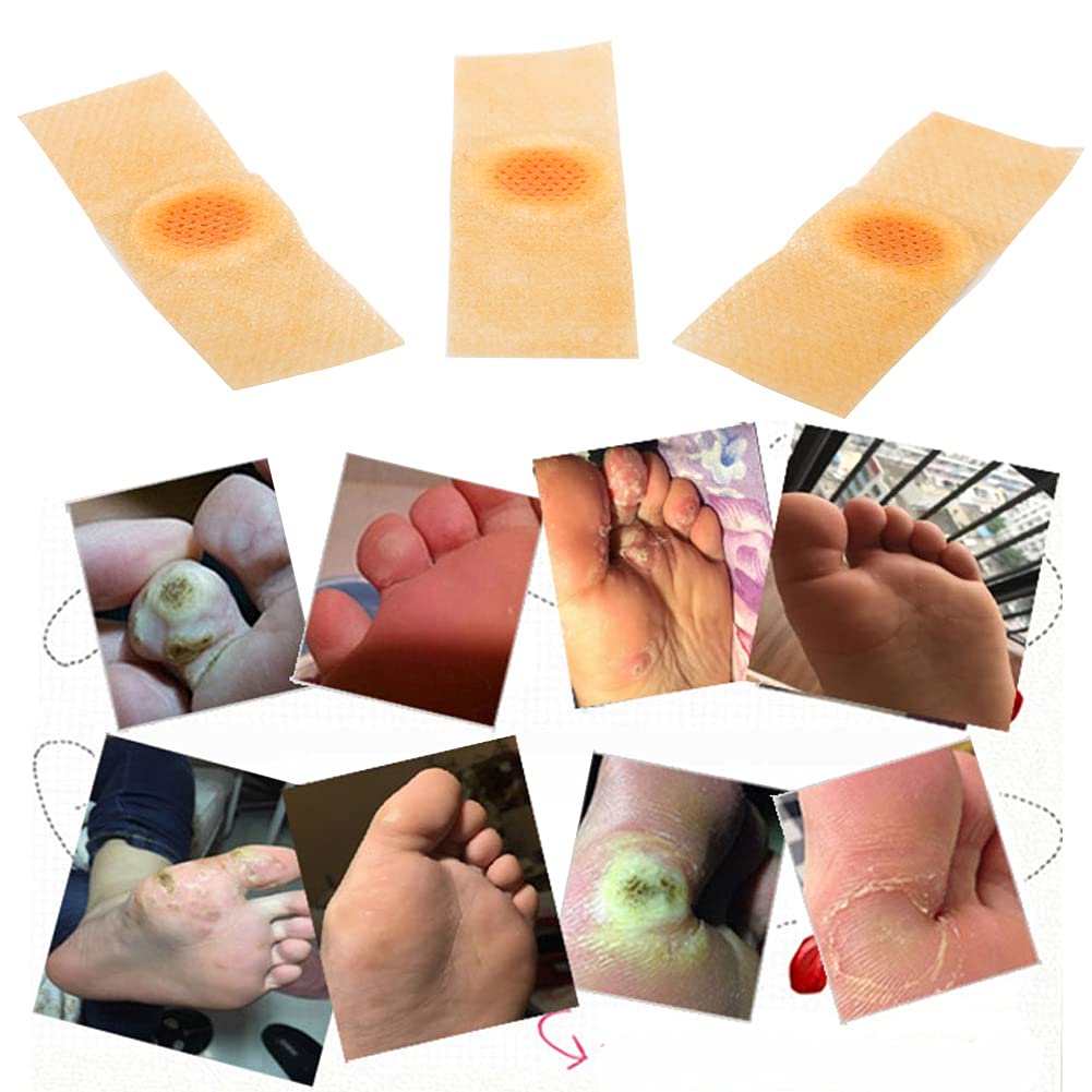 Cherioll Wart Remover, Wart Remover Pads, Wart Treatment, Wart Remover for Hands, Feet, Feet Callus Remove, Verruca and Wart, Relief Pain Removal Warts Plaster, Soften Skin Cutting Sticker Toe Protector, 20 PC