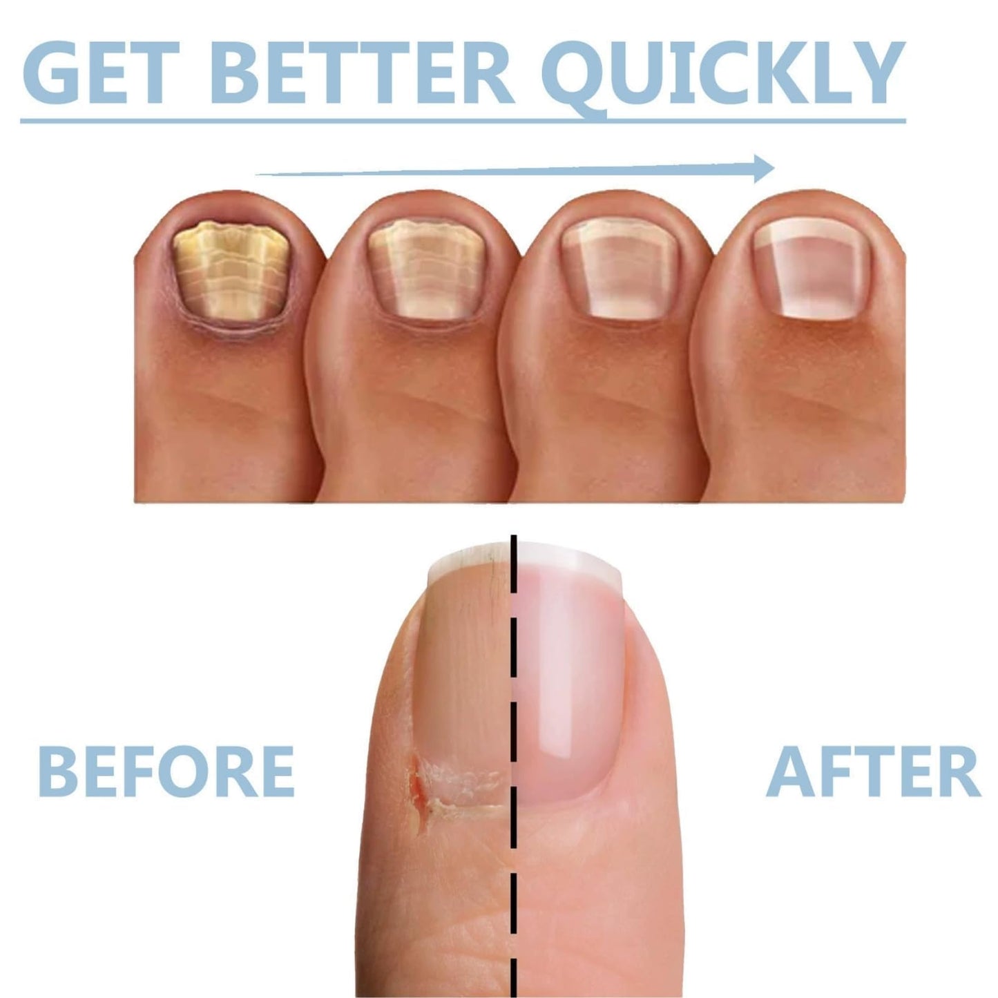 OunTechGlory Nail Strengthener for Damaged Nails - Nail Hardener Extra Strong and Growth - Revitalizing Fingernail Growth Serum - Strengthens and Hardens Weak Nails for Faster Growing