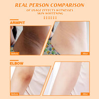 SEMECOMER Kojic Acid Underarm Whitening Cream, Skin Lightening Cream, Armpit Whitening Creams， Skin Bleaching for Armpits, Knees, Inner Thighs, Bikini, Intimate Areas, Reduces Odor, Absorbs Quickly