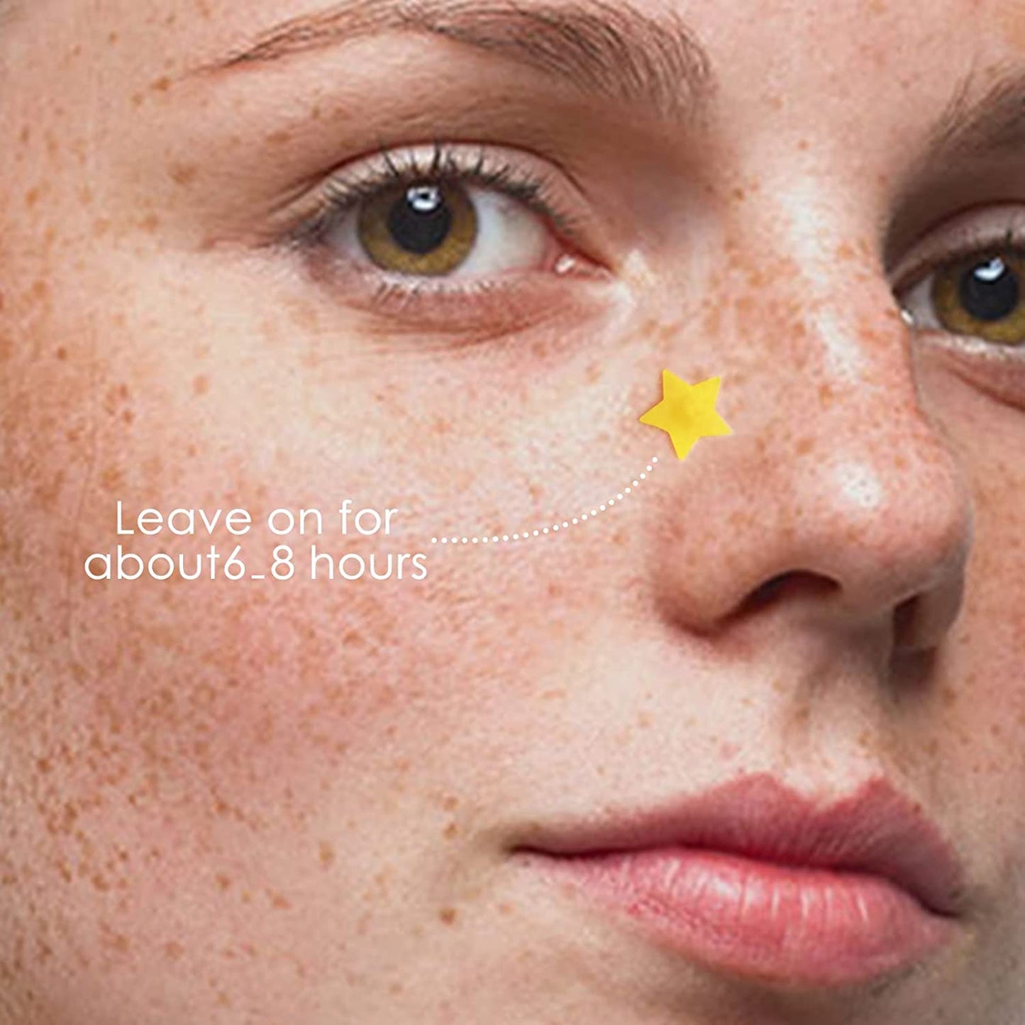 BAGLAK Star Shape Pimple Patch -300 Patches - Yellow & Blue, Hydrocolloid Patches - Pimple Stickers - Blemishes Patch - Facial Care