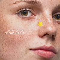 BAGLAK Star Shape Pimple Patch -300 Patches - Yellow & Blue, Hydrocolloid Patches - Pimple Stickers - Blemishes Patch - Facial Care