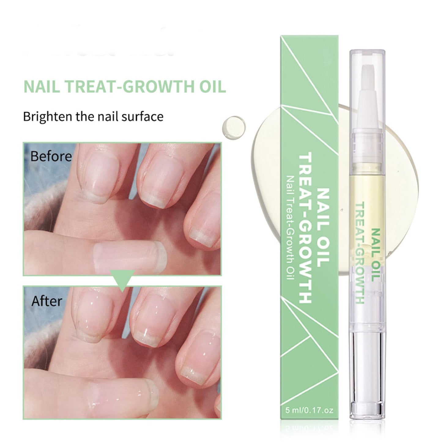 Generic 2 PCS Radiant Nail Growth Oil Pen - Cuticle and Nail Hydration Smooth Application Compact and Portable Design - Travel Friendly Quick Use Pen Applicator for Moisturize Dry Nails