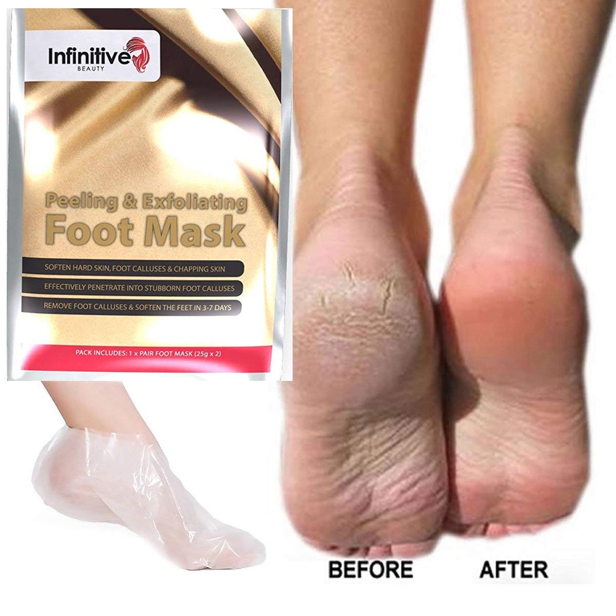 Infinitive Beauty Exfoliating Foot Mask Peeling Feet Masks Pair, Exfoliator, Exfoliater, Exfoliating Scrub, Whitening and Moisturiser, Clear Foot Odour, Remove Hard Dead Skin, Soft Feet, Cleanser, 7 Days Effective