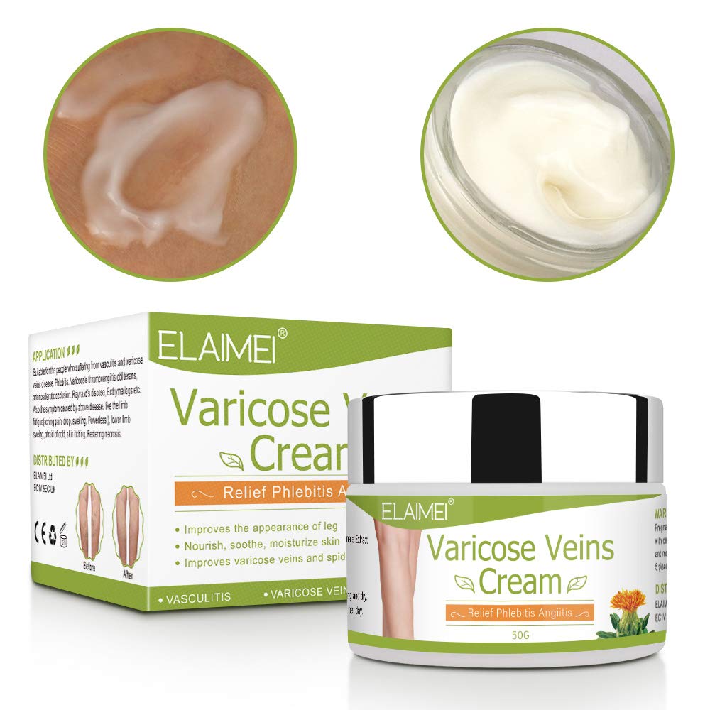 Solotree Varicose Veins Cream, Varicose Vein Treatment, Spider Vein Treatment Cream for Legs, Improve Blood Circulation, Tired and Heavy Legs Fast Relief