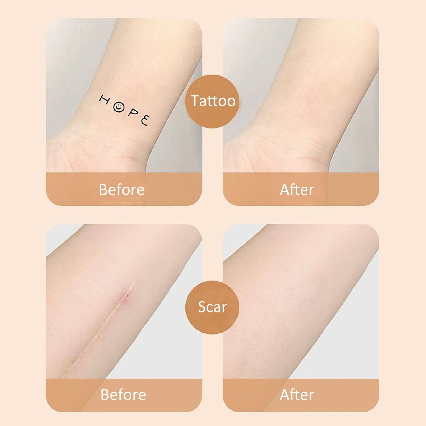 SHEBEEDO 10 PcsTattoo Cover Up Patch,High Coverage Ultra-Thin Skin Tattoo Cover Up Patch For Tattoos Scars Birthmarks Dark Spots, Long-Lasting Wear Waterproof,Seamless Makeup Stickers For Flawless Coverage