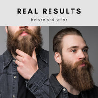 Prophet and Tools 2023 Favourite* Unscented Beard Oil, Revolutionary Formula Helps to Thicken Beard Growth, Soften Hairs, Relieve Itch & Flaking, Beard Comb Included, 30 Ml