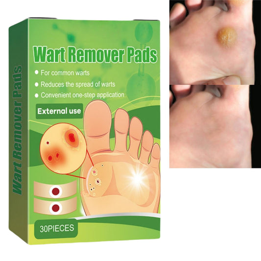 ChunBin 30PCS Verruca Treatment,Wart Treatment Patch,Wart Remover,Plantar Wart Remover for Hands,Pain Free Plasters for Adults,Stops Wart Regrowth,Repair Skin,Easy to Use,Non-Irritating Effective,Pain Relief
