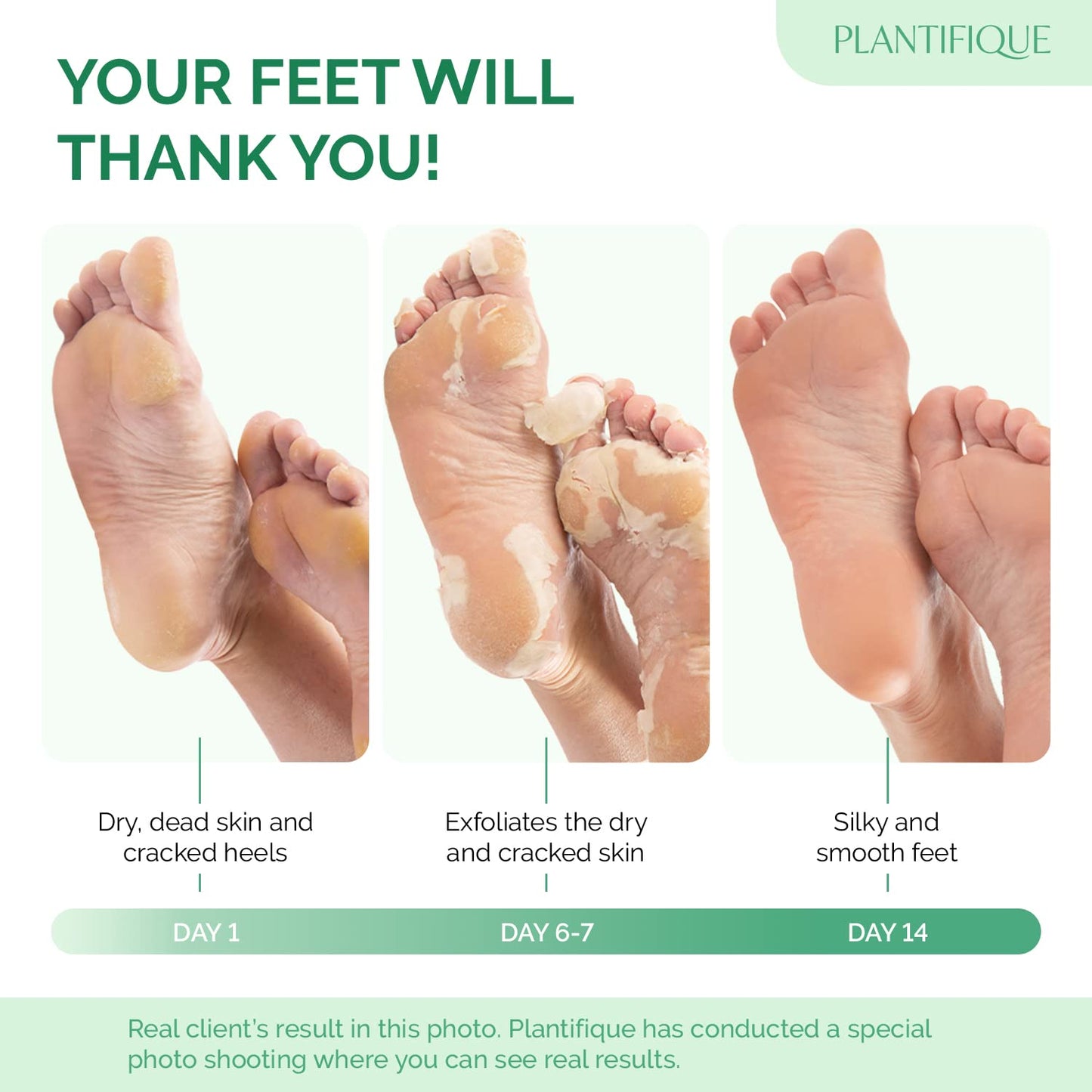 PLANTIFIQUE Plantifique Foot Peel Mask – 2 Pairs Exfoliating & Dermatologically Tested Foot Treatment, Removes Dead Skin & Repairs Heels for Soft Feet – Peach Scent, Gift for Women & Men
